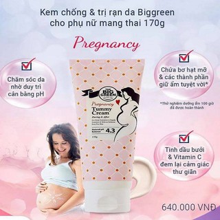 Kem chống và trị rạn da Biggreen cho phụ nữ mang thai 170g